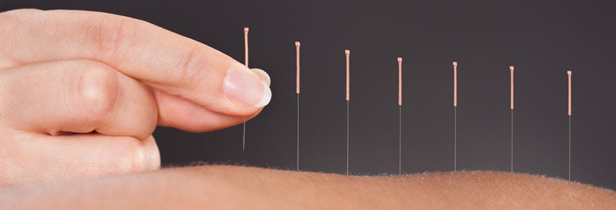 acupuncteur