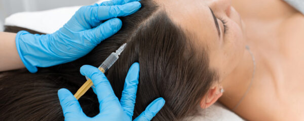 Injections de PRP cheveux