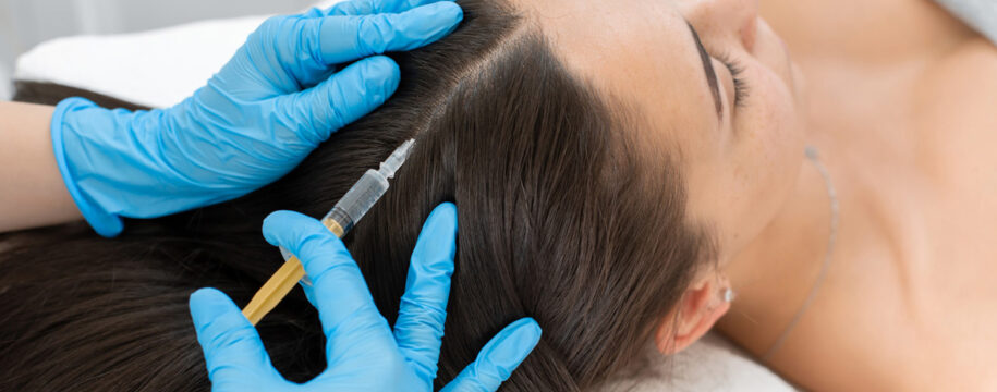 Injections de PRP cheveux
